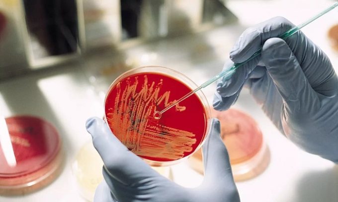 Бактериологический посев мочи поможет выявить, какой именно возбудитель вызывает заболевание